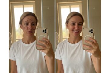 Comprei o Clareador Nutralfit Desconfiada… Mas o Resultado Me Surpreendeu