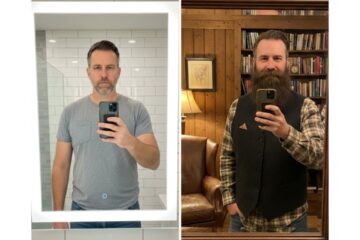 NANODERM TRIOXIDIL Funciona Mesmo Minha Experiência com o Tônico que Fez Minha Barba Crescer