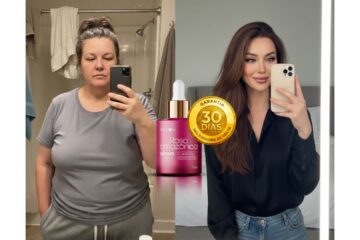 Rosa Amazônica Sérum Funciona Mesmo Minha Experiência Real com o Rejuvenescedor